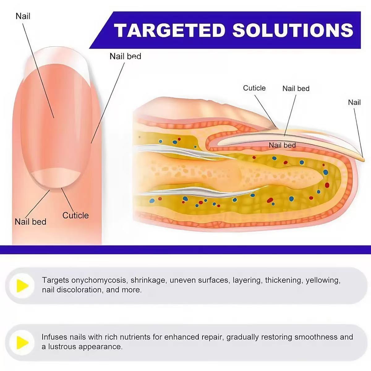 Nail Repair/Fungal Nail Patches