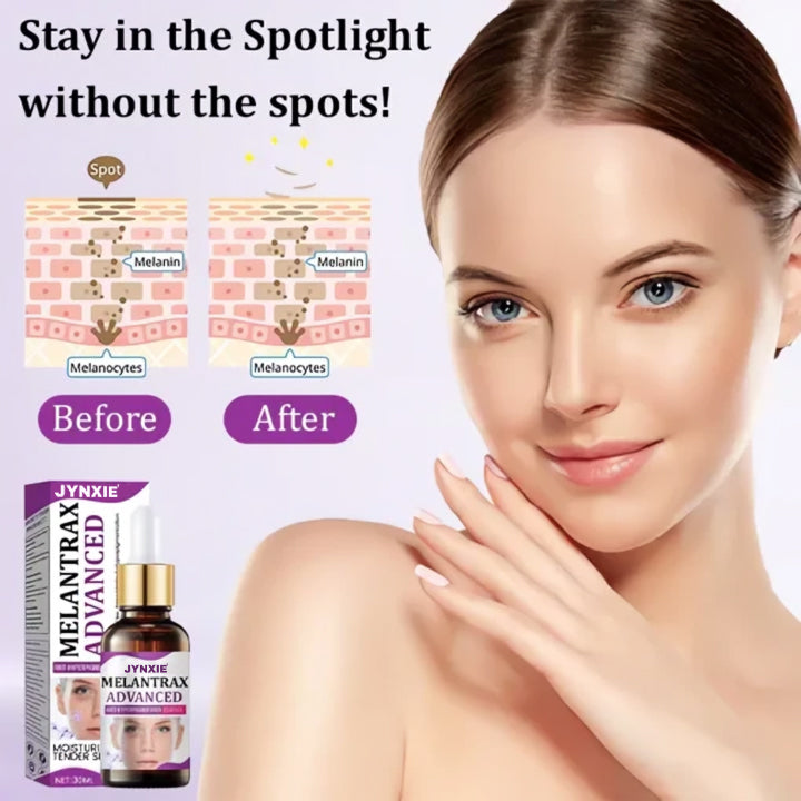 Jynxie® MelantraX Advanced Anti-Hyperpigmentation Essence