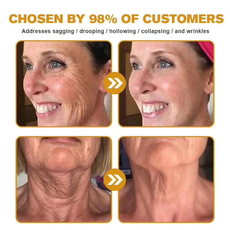 Aeehfeng® BOTOX Bee Venom Skin Repair Cream