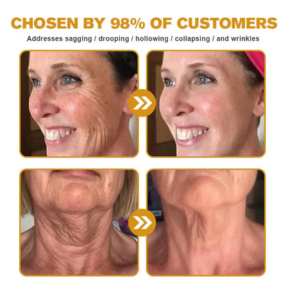 Aeehfeng® BOTOX Bee Venom Skin Repair Cream