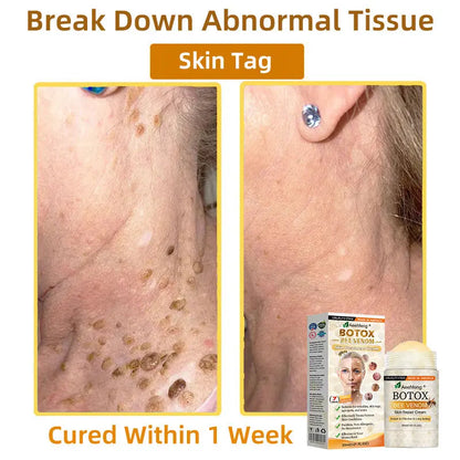 Aeehfeng® BOTOX Bee Venom Skin Repair Cream