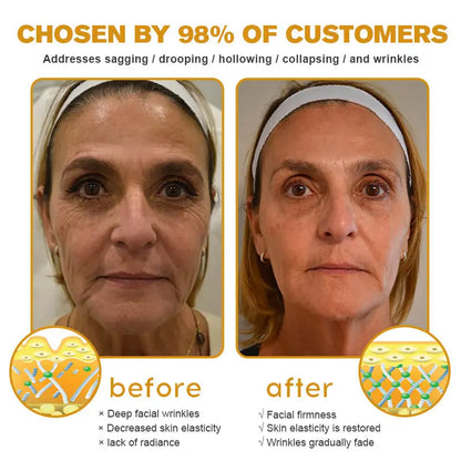 Aeehfeng® BOTOX Bee Venom Skin Repair Cream