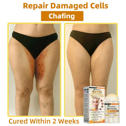 Aeehfeng® BOTOX Bee Venom Skin Repair Cream