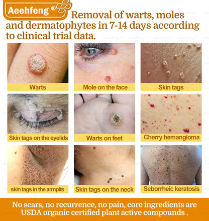 Aeehfeng® BOTOX Bee Venom Skin Repair Cream