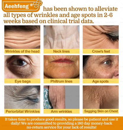 Aeehfeng® BOTOX Bee Venom Skin Repair Cream