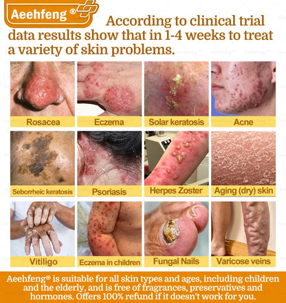 Aeehfeng® BOTOX Bee Venom Skin Repair Cream