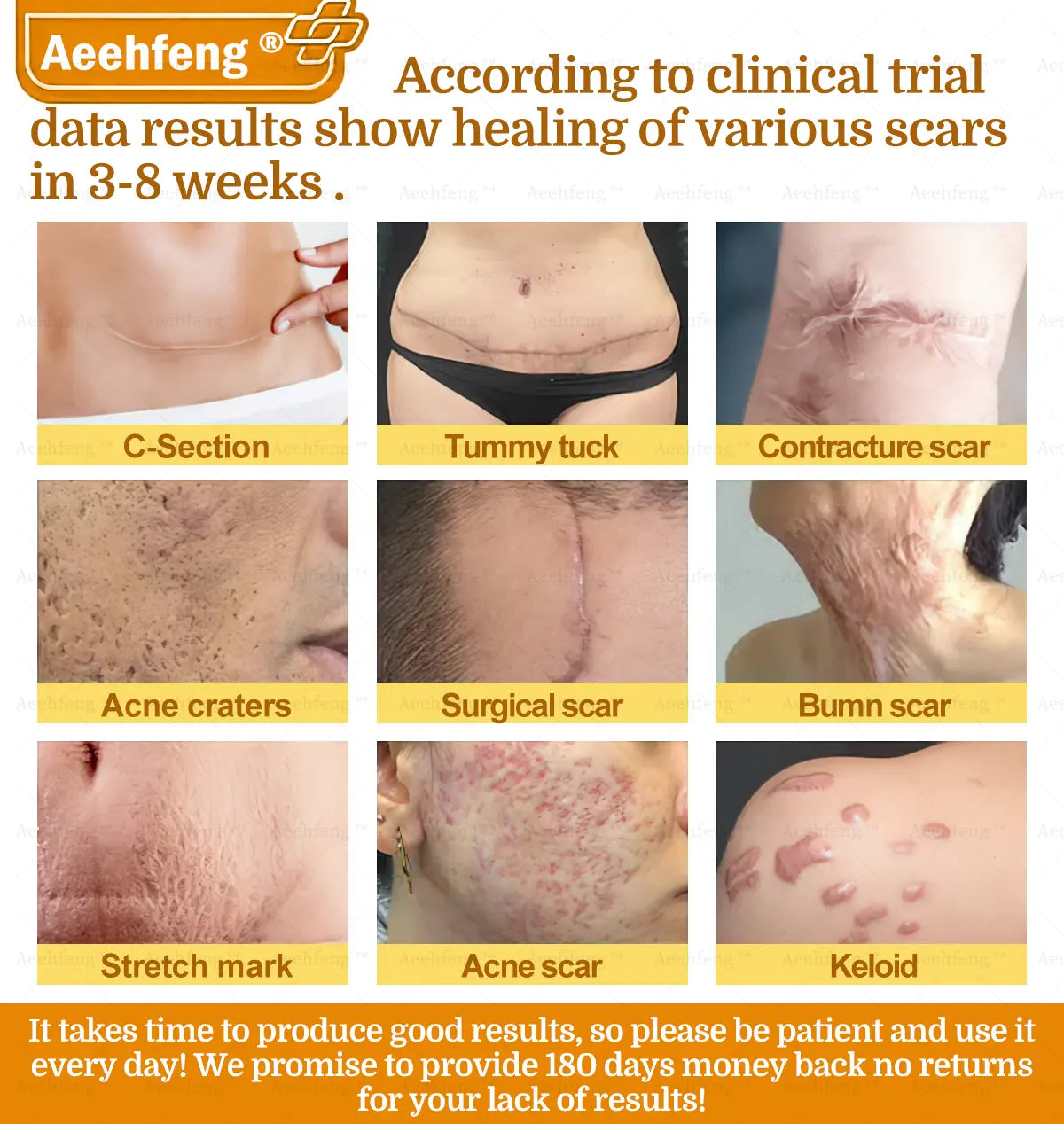 Aeehfeng® BOTOX Bee Venom Skin Repair Cream