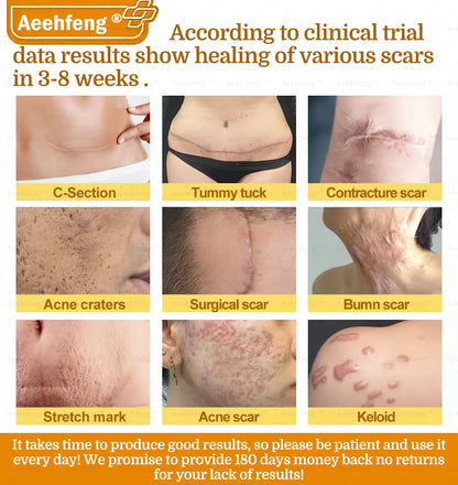 Aeehfeng® BOTOX Bee Venom Skin Repair Cream