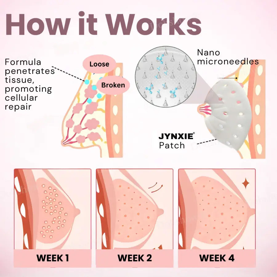 Jynxie® Breast Enhancement Nano Patch