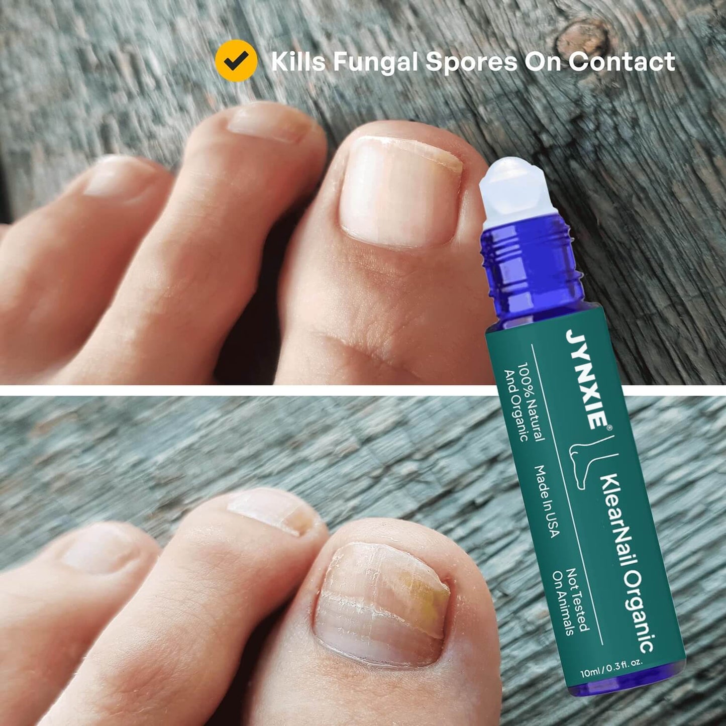 KlearNail Anti-Fungal Stick