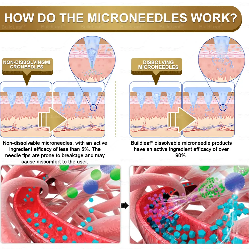 Jynxie® NIDDK-Tirzepatide Slimming & health NANO MICRONEEDLE PATCH