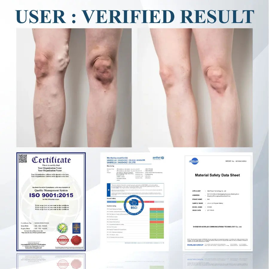 Fivfivgo® Black Cumin Edema Soothing Herbal Cream