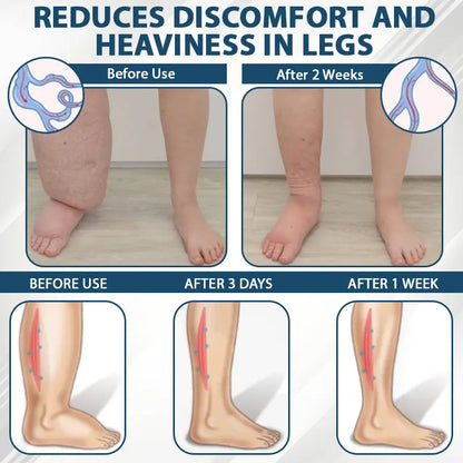 Fivfivgo® Black Cumin Edema Soothing Herbal Cream