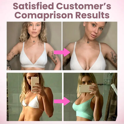 Jynxie® Breast Enhancement Nano Patch