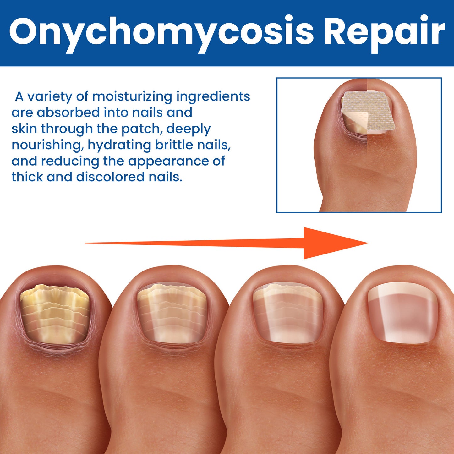 Nail Healing Antibacterial Patch