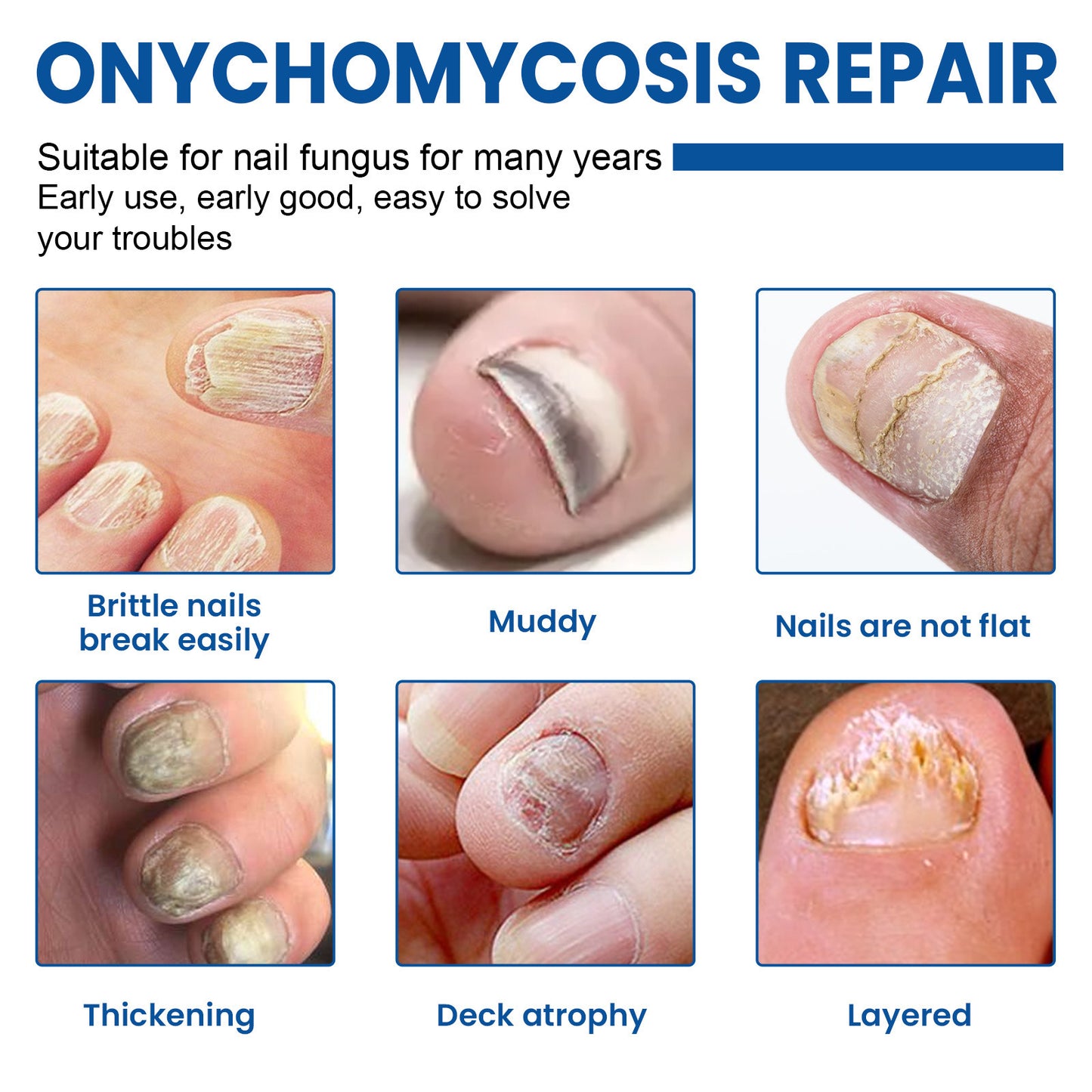 Nail Healing Antibacterial Patch