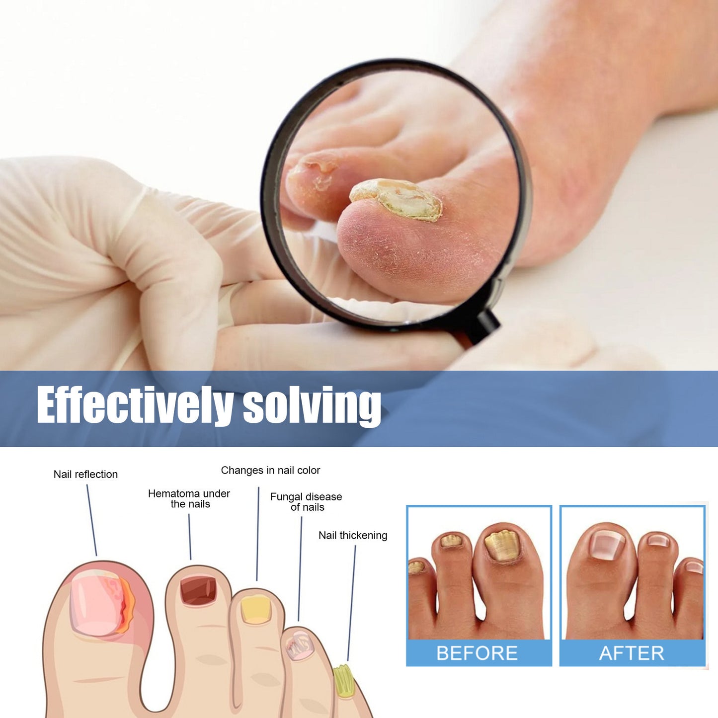 Nail Healing Antibacterial Patch