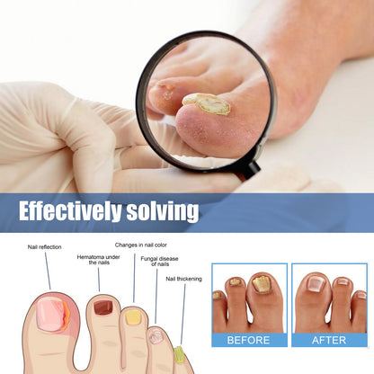 Nail Healing Antibacterial Patch